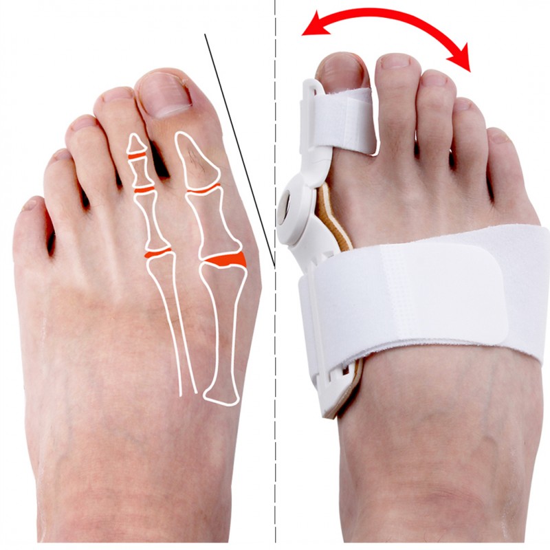 Foot Care Toe Bunion Splint Corrector Braces