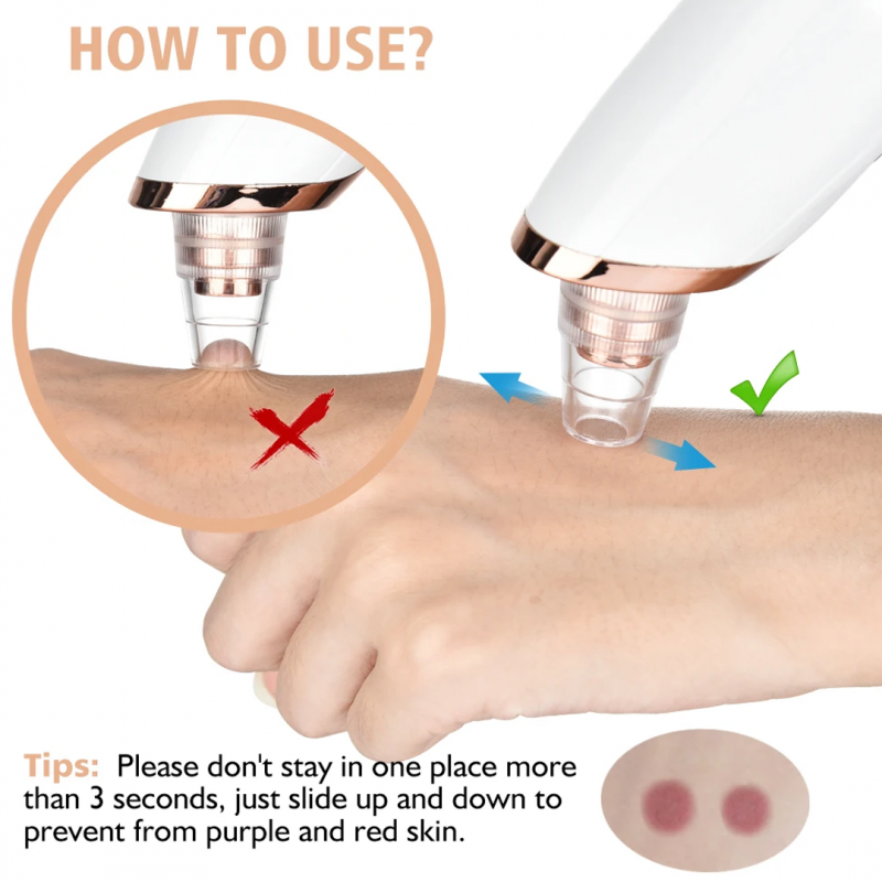 Skincare with Electric 5 in 1 Blackhead Acne Oil Remover | Shopright.pk