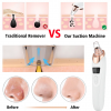 Skincare with Electric 5 in 1 Blackhead Acne Oil Remover | Shopright.pk